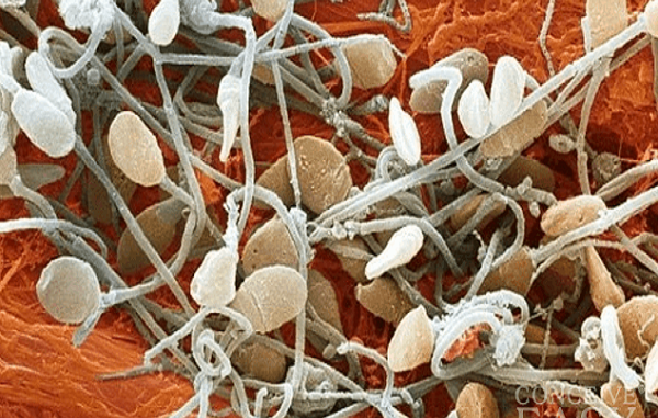 sperm-morphology